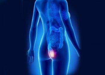 9 Naturmittel gegen Hämorrhoiden