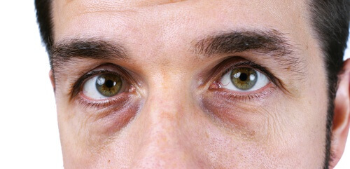 Mann mit Augenringen