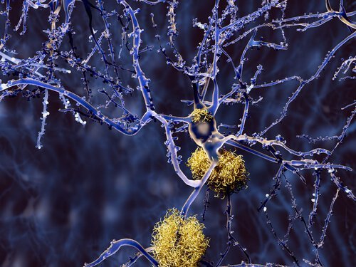 Kurkuma gegen Alzheimer