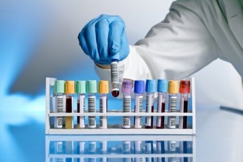 Neue HIV-Behandlung heilt britischen Patienten