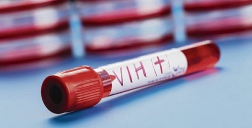neue-therapie-gegen-hiv