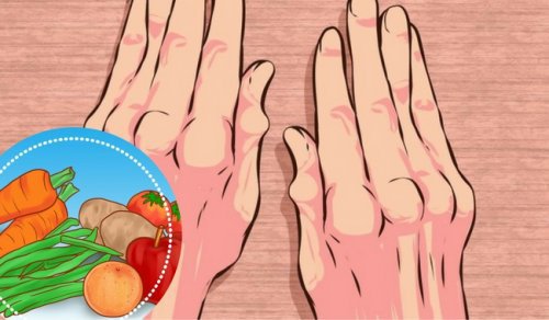Arthritis: 5 Nahrungsmittel, die bei deinem Frühstück nicht fehlen sollten