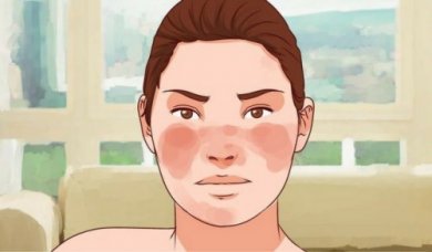 7 Dinge, die die Symptome von Lupus lindern könnten