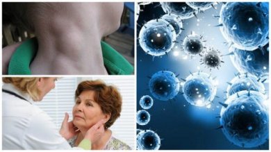 Lymphom: schleichende Krebserkrankung, die bei frühzeitiger Erkennung geheilt werden kann