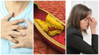 Erhöhter Cholesterinspiegel: 10 Symptome, die du beachten solltest!