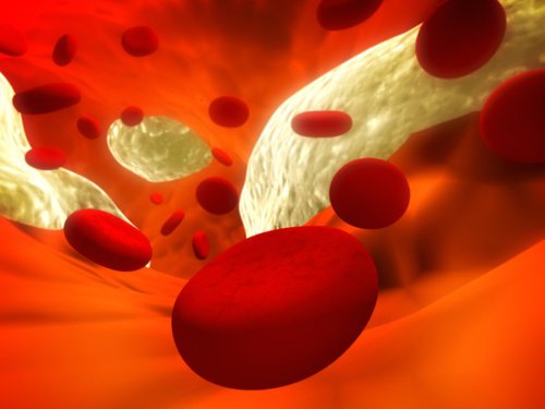 12 natürliche Heilmittel zur Vorsorge von Arteriosklerose 12 natürliche Heilmittel zur Vorsorge von Arteriosklerose