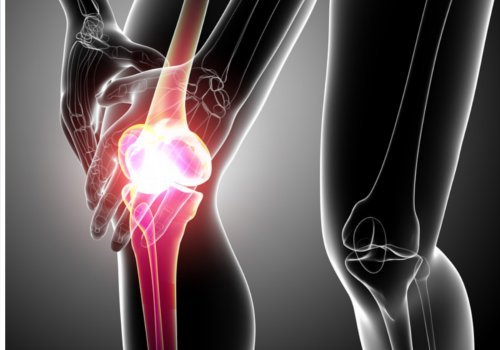 Knie Schmerzen