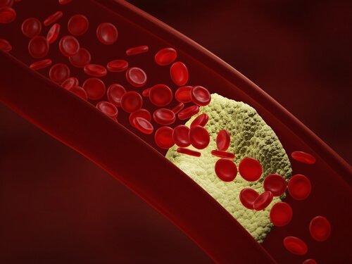 Arterien
