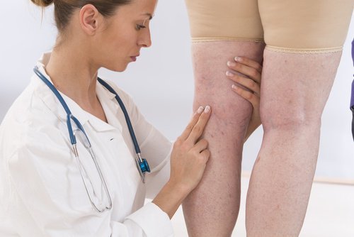 Ärztin mit Patientin mit Flüssigkeitseinlagerungen Ärztin mit Patientin mit Flüssigkeitseinlagerungen