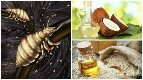 5 effektive Hausmittel gegen Kopfläuse 5 effektive Hausmittel gegen Kopfläuse