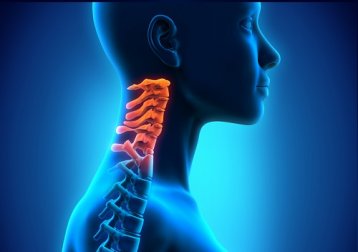 4 Übungen gegen Schmerzen in der Halswirbelsäule