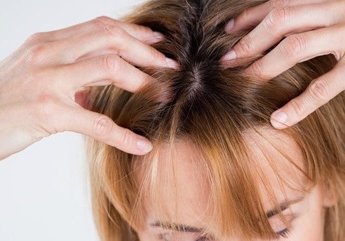 Frau macht Kopfmassage gegen Kopfschmerzen