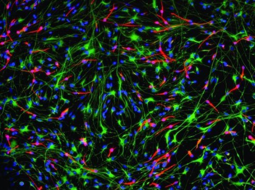 Neurogenese