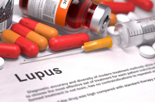 Lupus