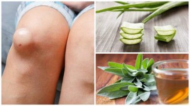 Flüssigkeit im Knie: 5 entzündungshemmende Naturheilmittel