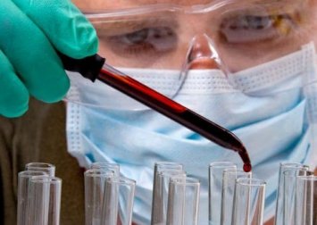 Ein einfacher Bluttest soll zukünftig Tumore lokalisieren