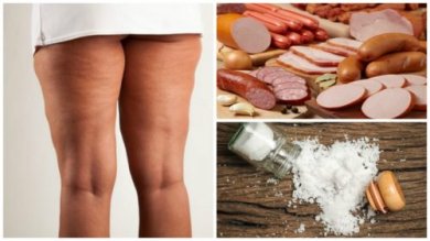 Vorsicht Cellulite: 7 Nahrungsmittel auf die du verzichten solltest