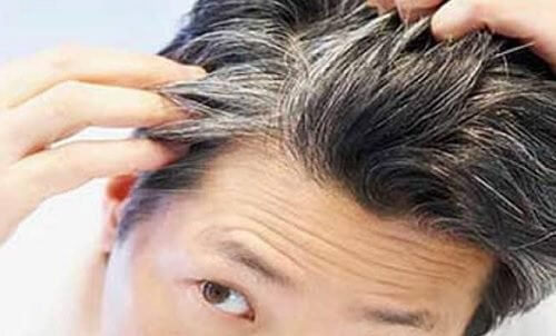 6 Vitalstoffe gegen das frühzeitige Ergrauen der Haare