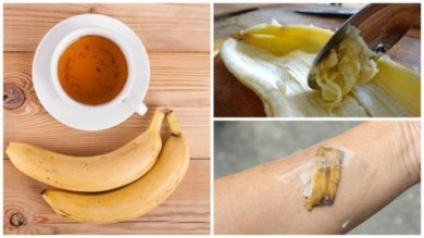 5 Verwendungsmöglichkeiten von Bananenschalen als Naturheilmittel