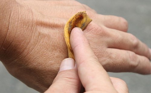 Bananenschalen gegen Warzen