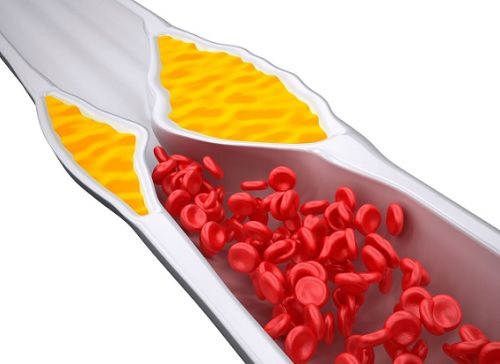 4 Mixgetränke zur Regulation des Cholesterinspiegels 4 Mixgetränke zur Regulation des Cholesterinspiegels