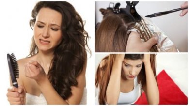 Du leidest unter starkem Haarausfall: Diese 7 Gründe können die Ursache sein