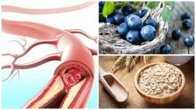 Gesunde Arterien: Diese 9 Nahrungsmittel können helfen