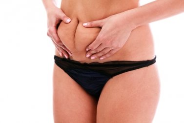 Weg mit dem Speckbauch!