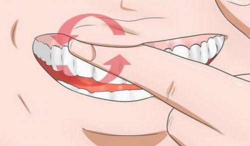 Soforthilfe bei Zahnfleischentzündung: 8 Hausmittel