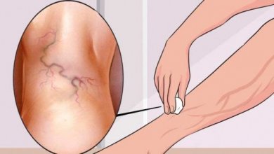 8 Übungen zur Vorbeugung von Krampfadern