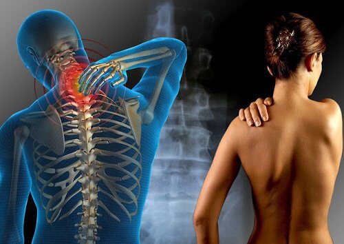 Fibromyalgiesyndrom – Therapie- und Behandlungsmöglichkeiten Fibromyalgiesyndrom – Therapie- und Behandlungsmöglichkeiten