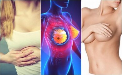 9 Symptome von Brustkrebs, die jede Frau kennen sollte
