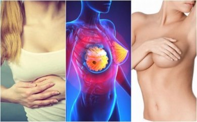 9 Symptome von Brustkrebs, die jede Frau kennen sollte