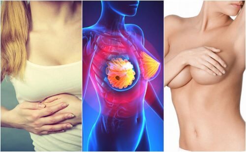 9 Symptome von Brustkrebs, die jede Frau kennen sollte