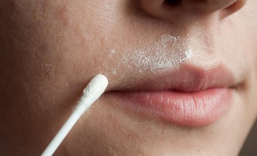 haarentfernung ober den lippen