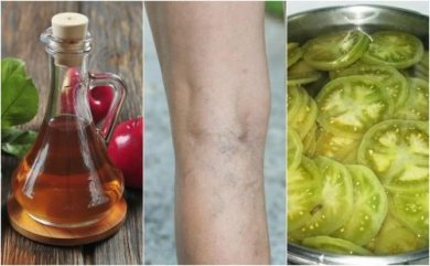 Grüne Tomaten und Essig gegen Krampfadern
