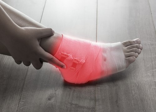 verstauchten Knöchel richtig behandeln