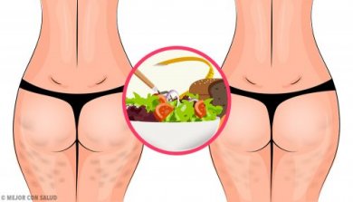 Cellulite bekämpfen mit gesunder Ernährung
