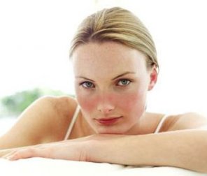 Systemischer Lupus Erythematodes