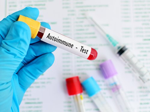 Systematischer Lupus Erythematodes kann verschiedene Ursachen haben.