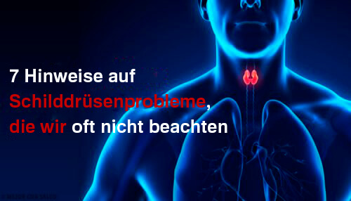 7 Anzeichen einer Schilddrüsenerkrankung 7 Anzeichen einer Schilddrüsenerkrankung