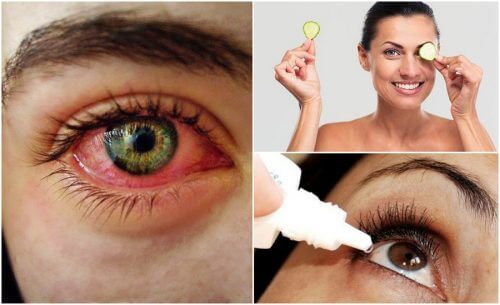 Trockenes Auge: das kannst du tun! Trockenes Auge: das kannst du tun!
