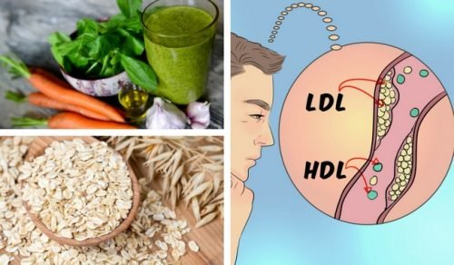 Arterienverkalkung durch Cholesterin? 5 Hausmittel