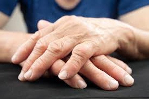 Übersäuerung kann zu Arthritis in den Händen führen.
