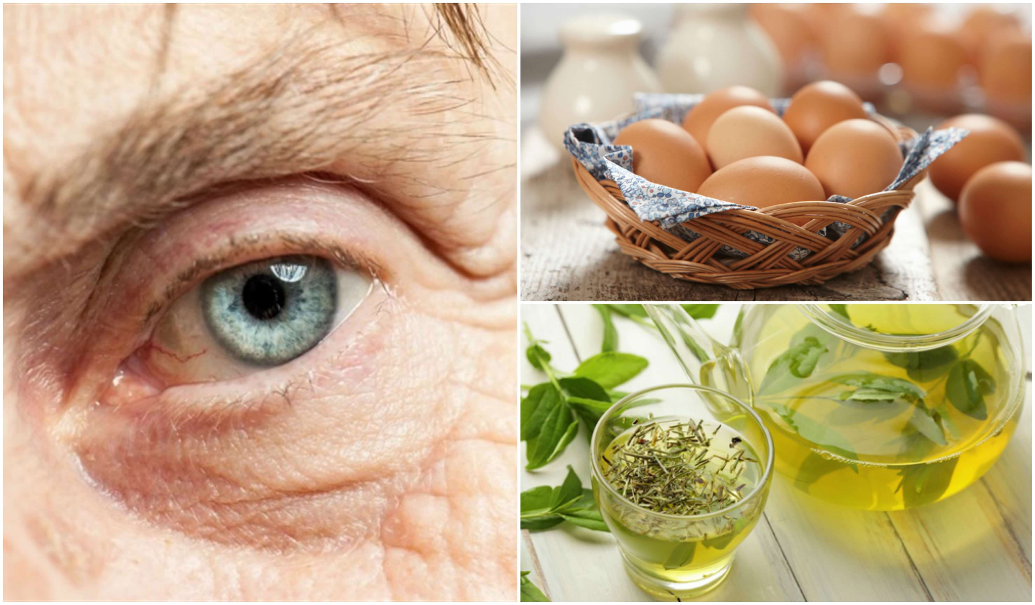 Ernährung zur Vorsorge gegen Makuladegeneration Ernährung zur Vorsorge gegen Makuladegeneration