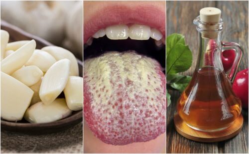 6 natürliche Mittel gegen Candidosis 6 natürliche Mittel gegen Candidosis