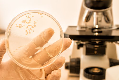 Richtige Diagnose: grundlegende Voraussetzung in der Behandlung einer Candida-Infektion