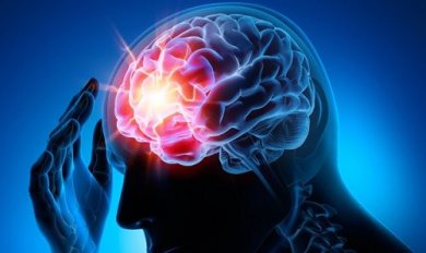 Mit diesen 7 Ratschlägen kannst du einem Aneurysma vorbeugen