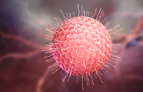 Herpes Zoster (Gürtelrose)