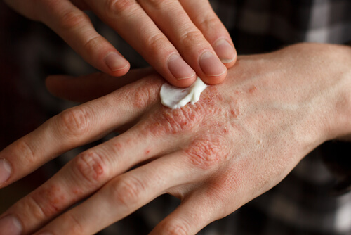 Linien Auf Den Nageln Und Wie Man Sie Los Wird Besser Gesund Leben